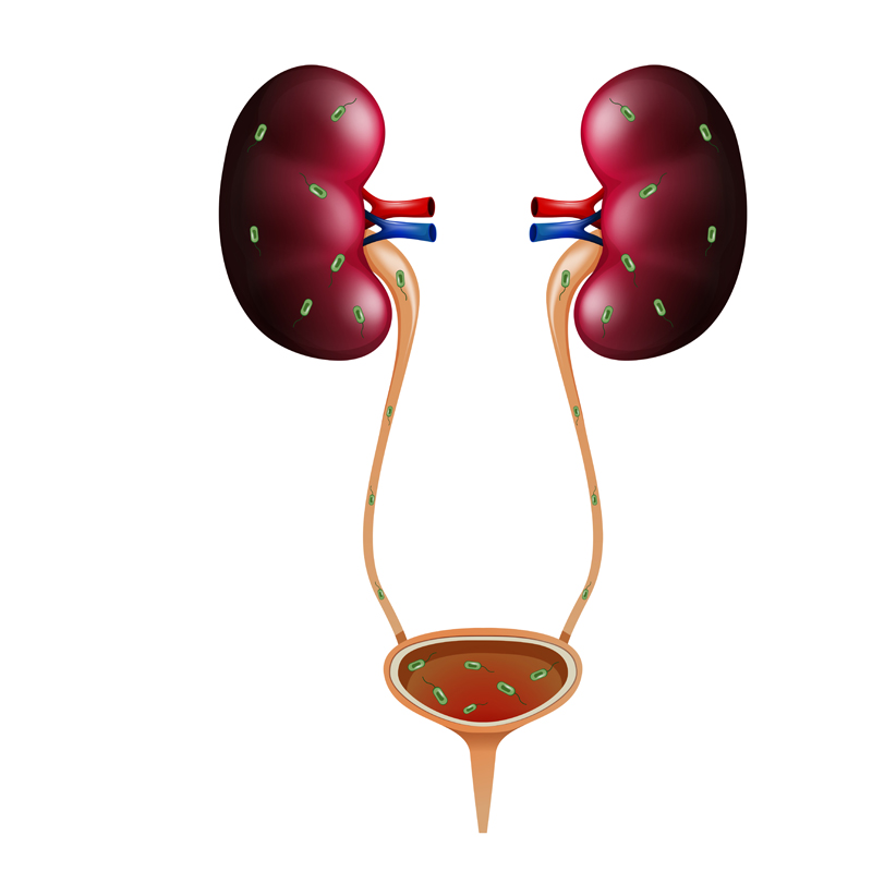 urologo en tuxtepec cirugia de Cálculo Uretral