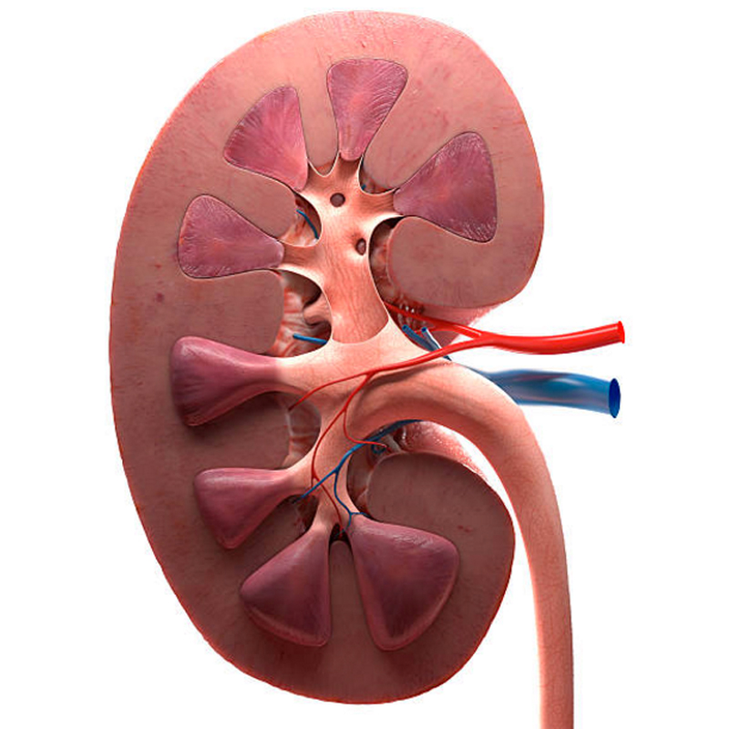 urologo en tuxtepec calculos